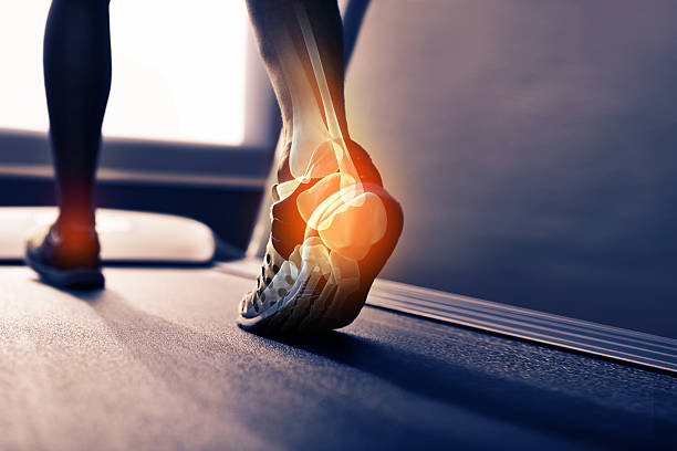 Douleur chronique au tendon d’Achille, trail et fascias